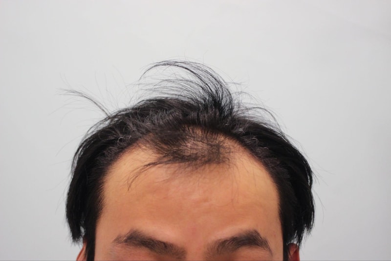 포토후기 이미지