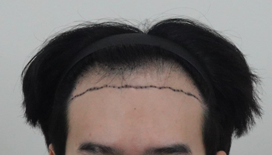 포토후기 이미지