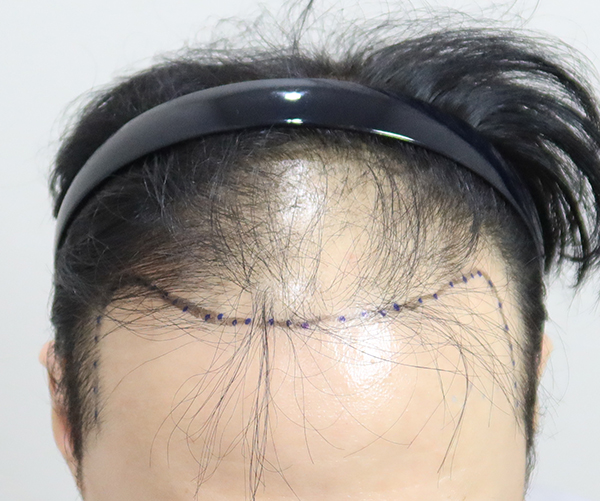 포토후기 이미지