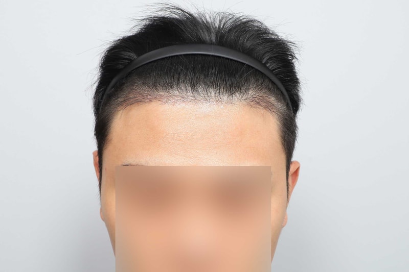 포토후기 이미지
