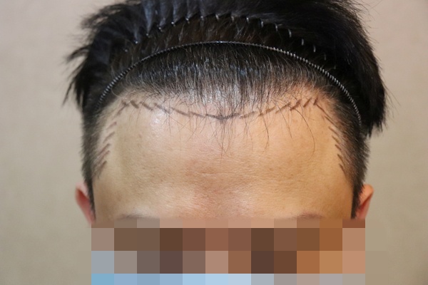 포토후기 이미지