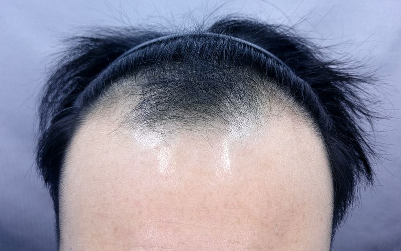 포토후기 이미지