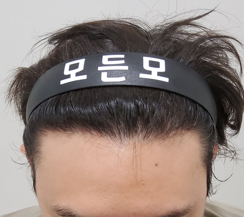 5. 수술후_1년_2.jpg