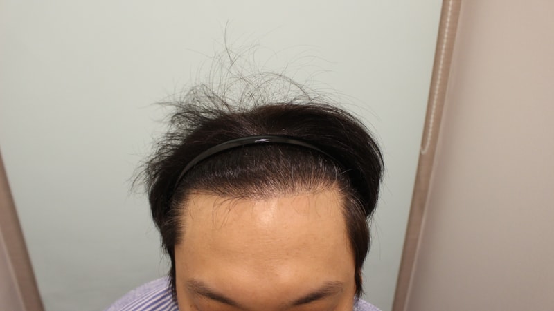 후1.jpg