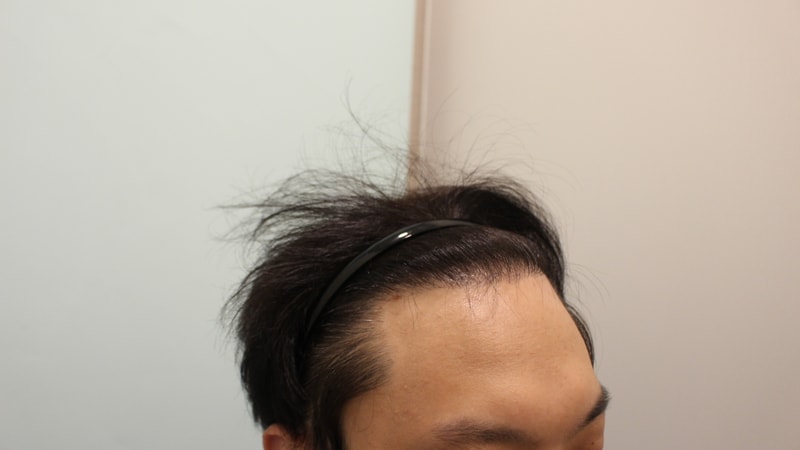 후2.jpg
