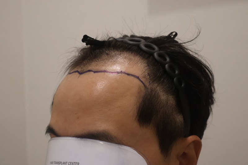 포토후기 이미지
