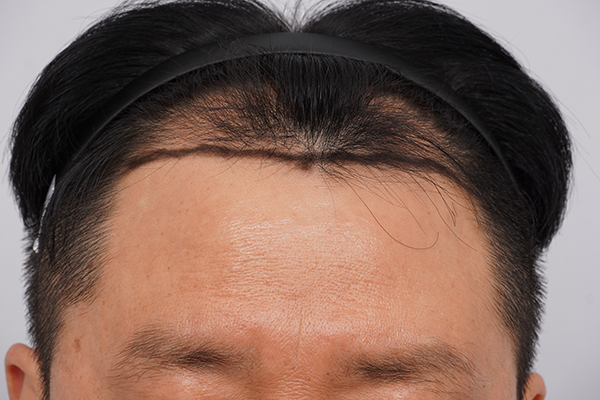 포토후기 이미지