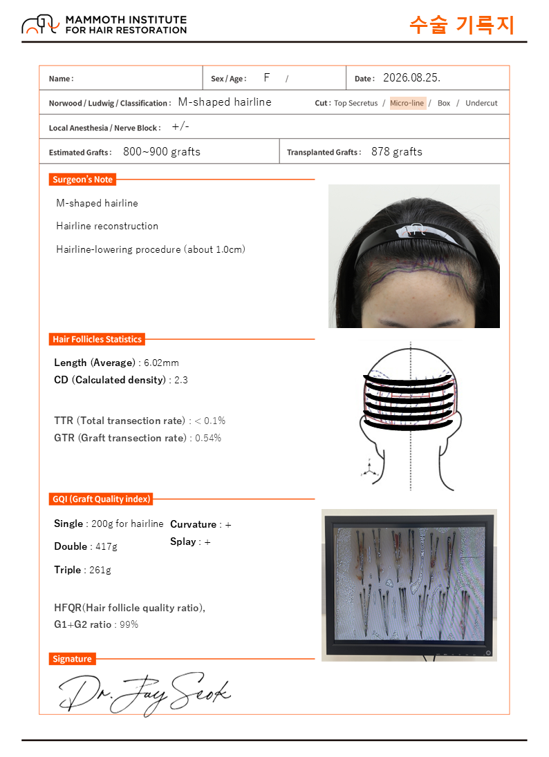 포토후기 이미지