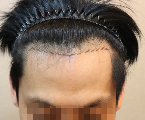 포토후기 이미지