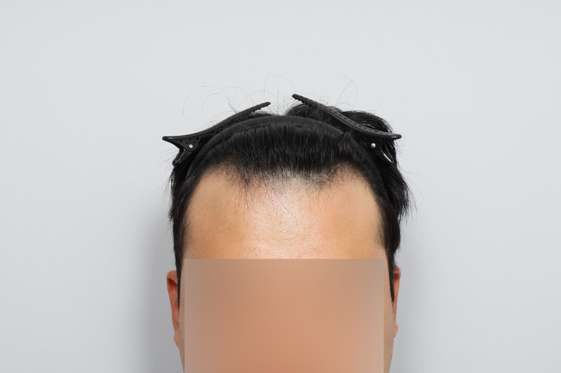 포토후기 이미지