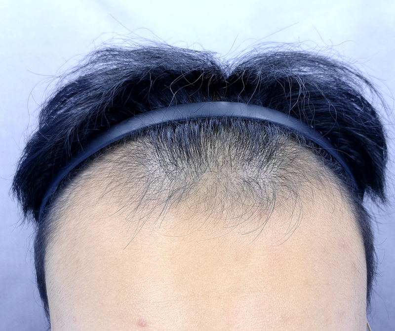 포토후기 이미지