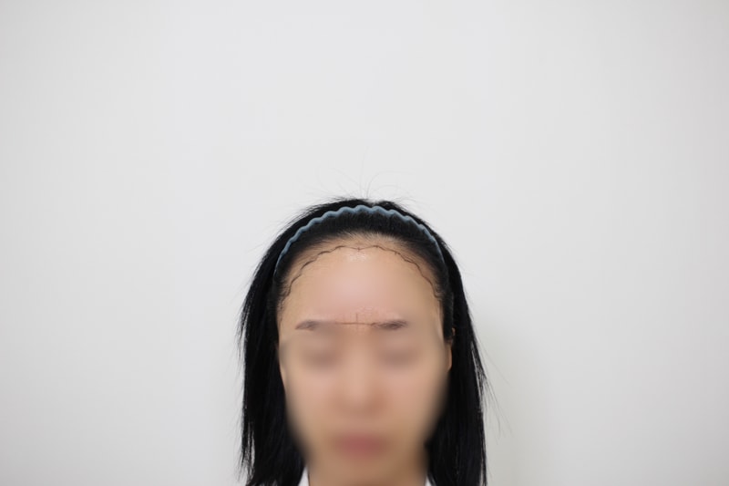 수술전디자인2.jpeg