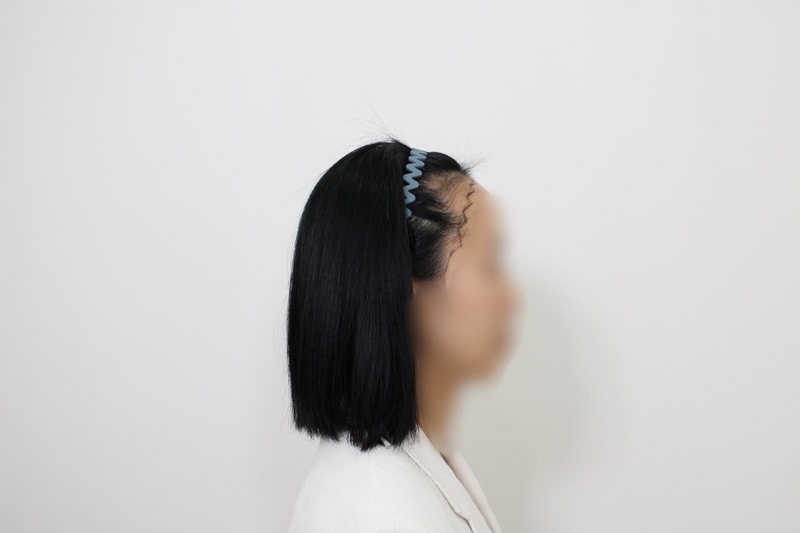 수술전디자인3.jpeg