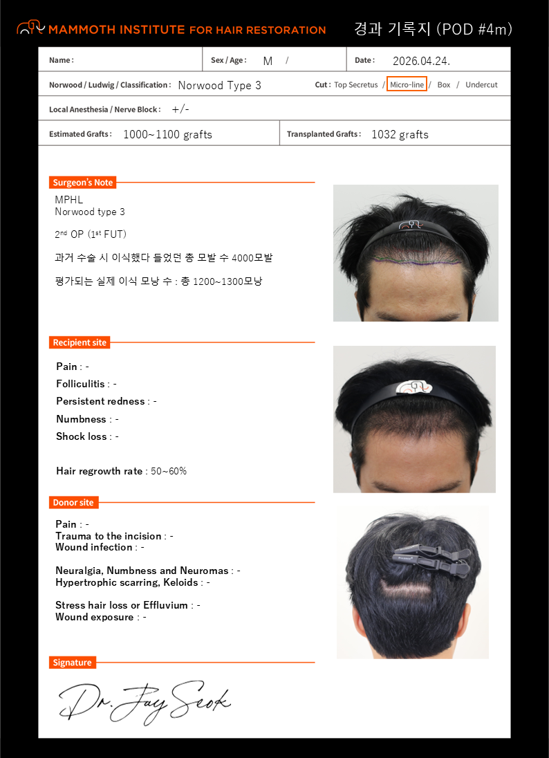 포토후기 이미지