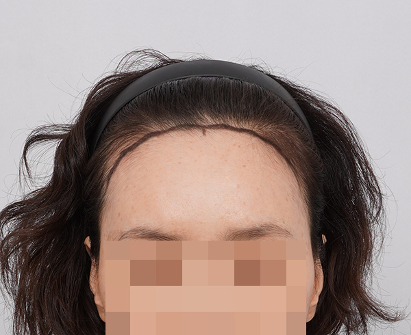 포토후기 이미지