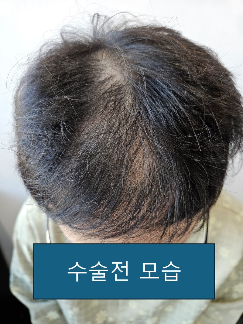 포토후기 이미지