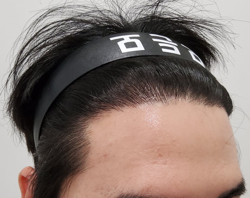 4. 수술후_1년_3.jpg