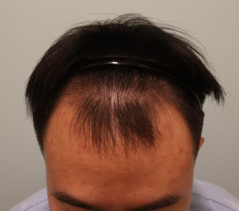 포토후기 이미지