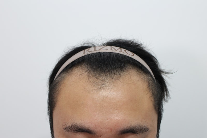 포토후기 이미지
