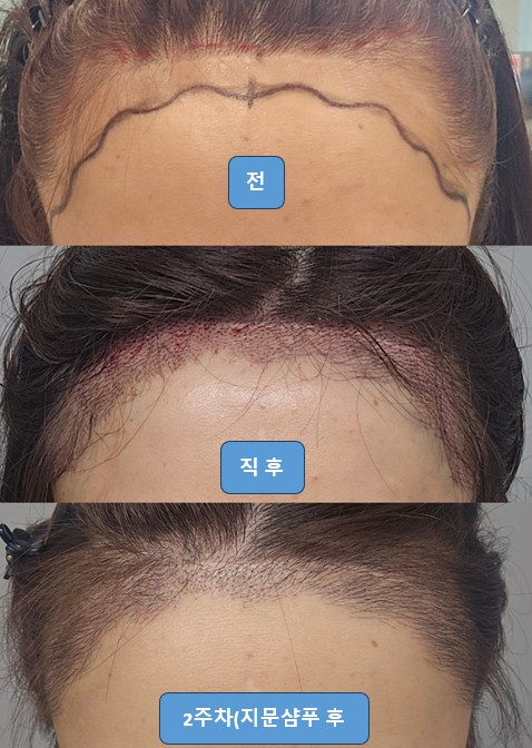 포토후기 이미지