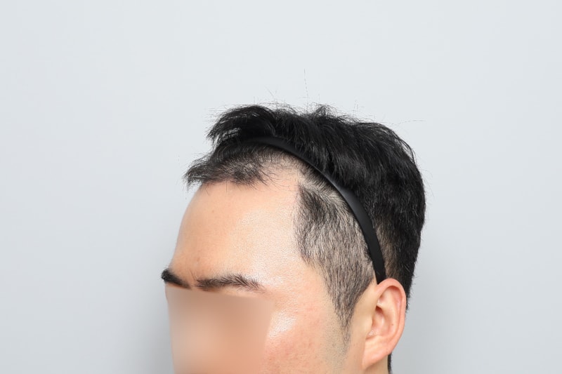 수술전-(4).jpg