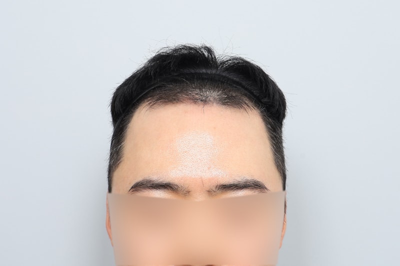 수술전-(17).jpg
