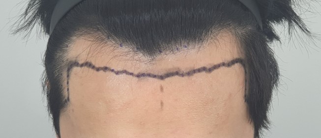 포토후기 이미지