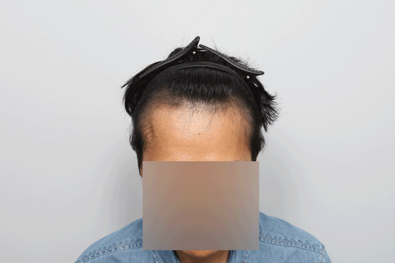 포토후기 이미지