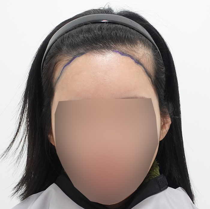 포토후기 이미지