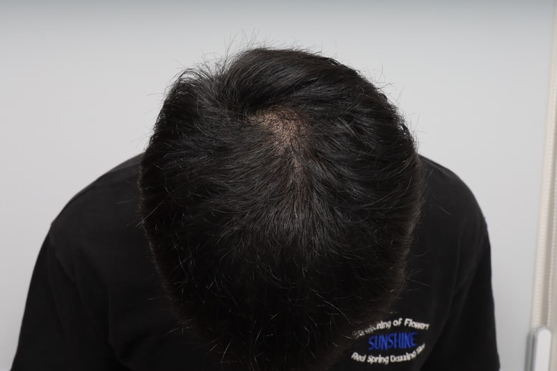 후1.jpg