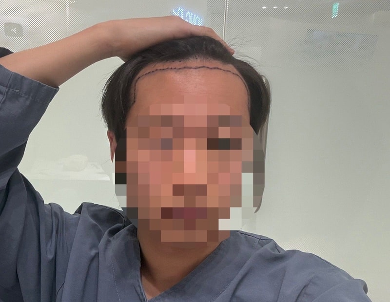 포토후기 이미지