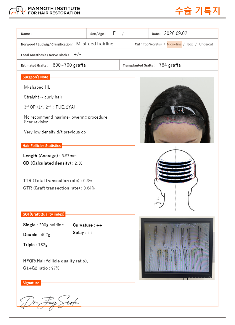 포토후기 이미지