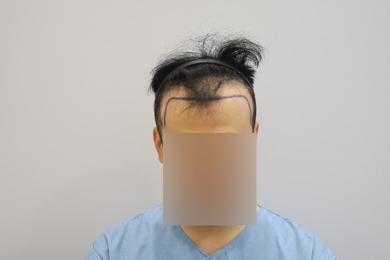 수술전디자인-(14).jpg