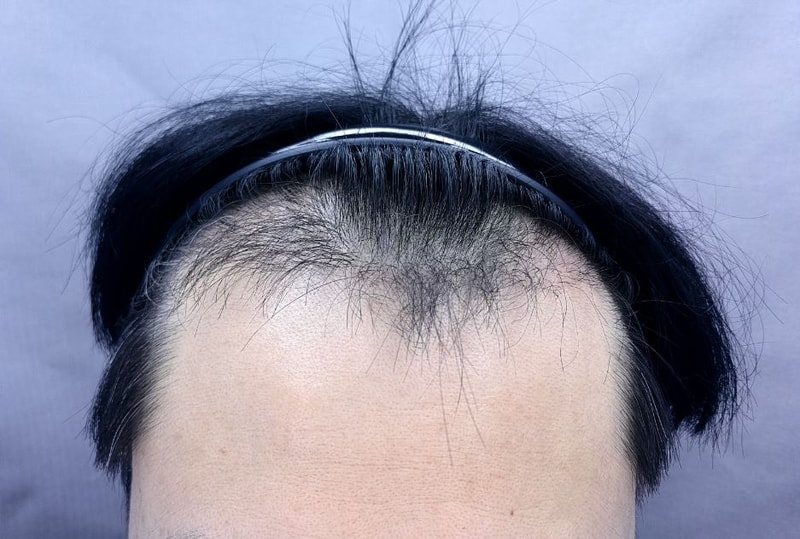 포토후기 이미지