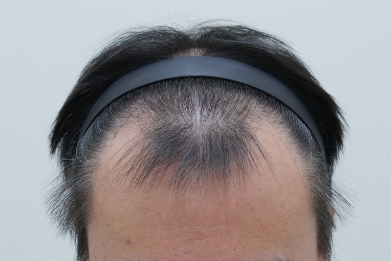 수술전1.jpg