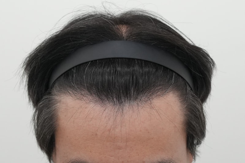 수술후1.jpg