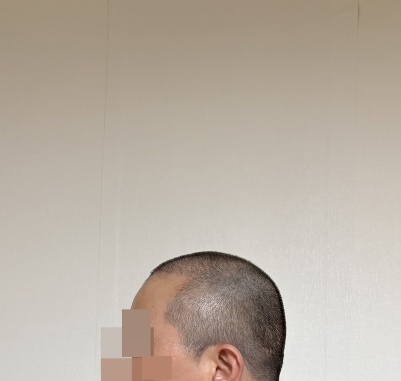 수술후 (3).jpg