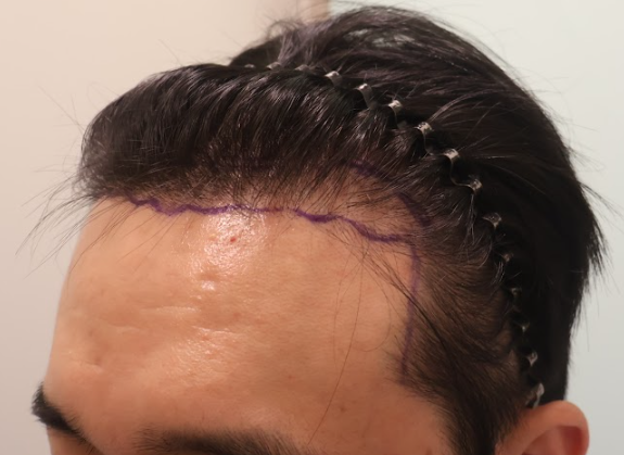 image1.png
