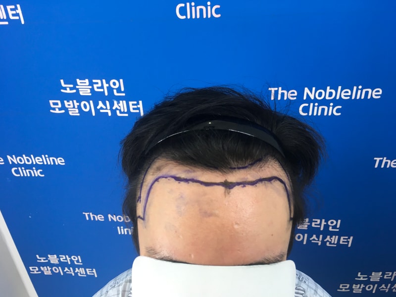 포토후기 이미지
