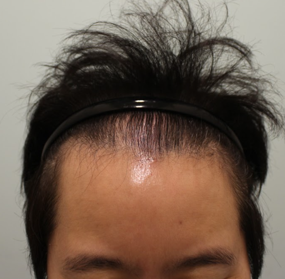 포토후기 이미지