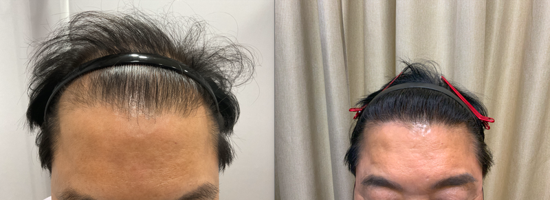 포토후기 이미지