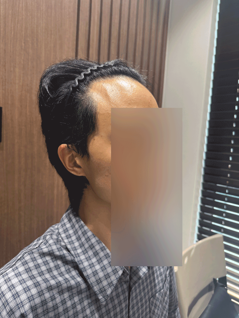 ㅈ4.gif