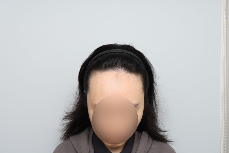 포토후기 이미지