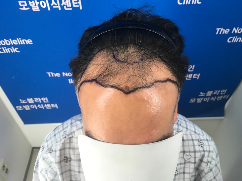 포토후기 이미지