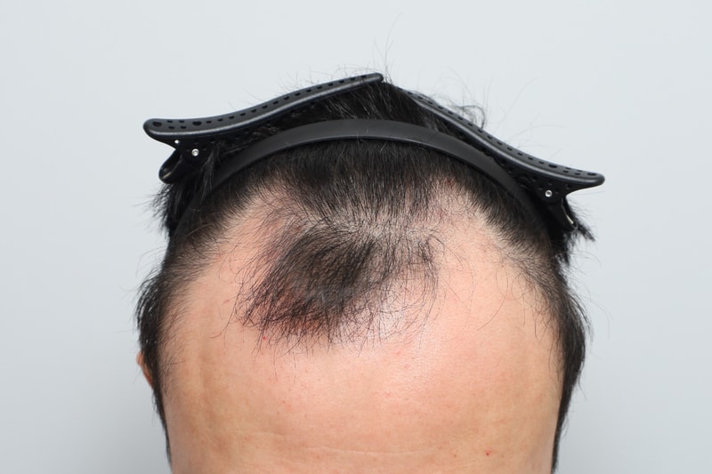 포토후기 이미지