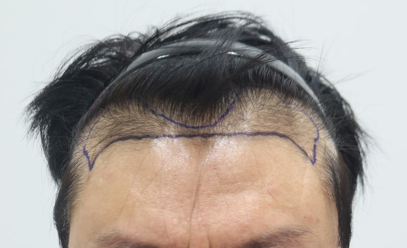 포토후기 이미지