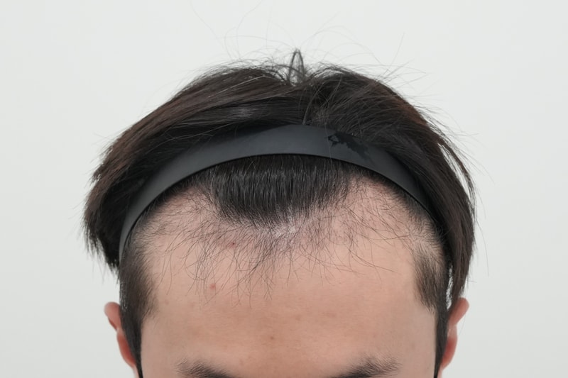3개월암흑기.jpg