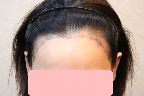 포토후기 이미지