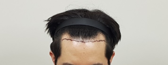 포토후기 이미지