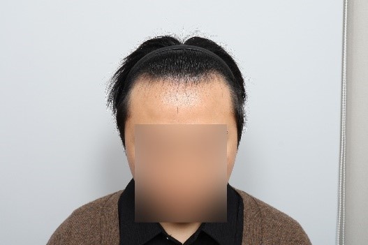 포토후기 이미지